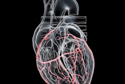 2021 05 28 15 53 3076 Artery Heart 3 D 400