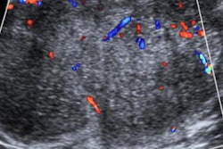 2023 04 07 19 54 1994 2023 04 11 Breast Lesions In Children Fig6 20230407191017