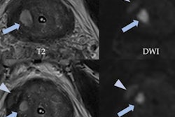 2023 04 17 21 54 3516 2023 04 19 Mri Insider Figure 25 20230417210726