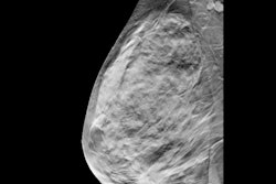 2022 02 02 22 46 3600 Breast Tomosynthesis Digital 400