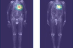 2023 05 01 16 29 3135 2023 04 14 Ai Scintigraphy 20230501160749