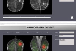 2023 05 02 03 19 3663 2023 05 02 Radiology Ai Mammo Interface 20230502030046