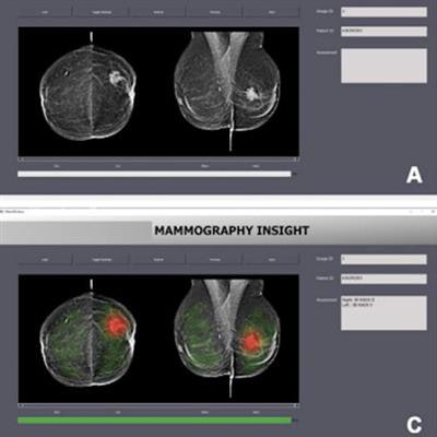 2023 05 02 03 19 3663 2023 05 02 Radiology Ai Mammo Interface 20230502030046