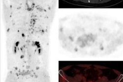 2023 05 11 20 11 5480 2023 05 11 Heterodimer Pet 20230511204547