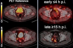 2023 05 26 22 47 8742 2023 05 26 Spect Prostate 400