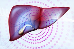 2022 06 24 17 38 0783 Liver Gallbladder 400