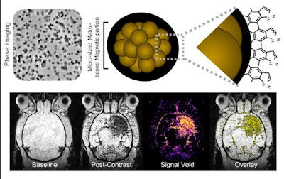 Mapping neuroinflammation using a new family of contrast agents ('Immuno-MRI') targeting activated endothelial cells in the central nervous system. The clinical development of this new tool is ongoing. Image courtesy of Dr. Maxime Gauberti.