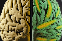 2023 06 05 17 24 7348 Cannabis Brain 400