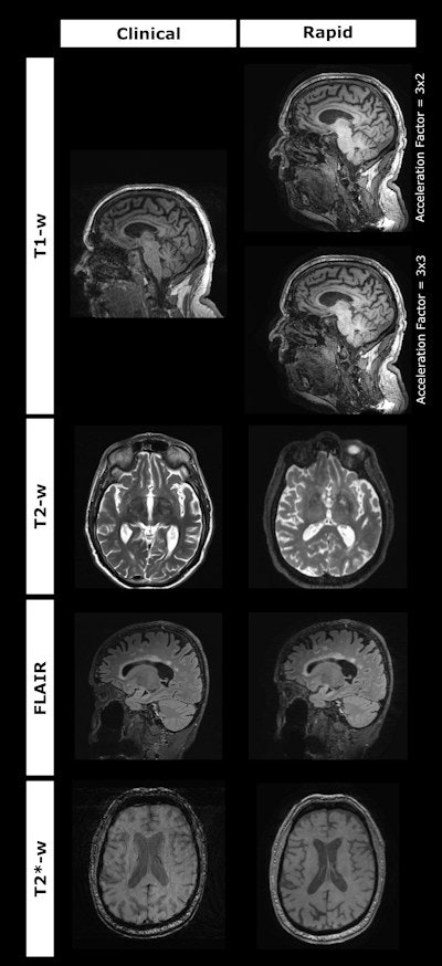 Examples of scans acquired from the clinical and rapid protocols for each sequence. Image and caption courtesy of Haroon Chughtai, PhD.