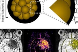 2023 06 12 16 13 1448 2023 06 04 Mri Contrast 20230612165359