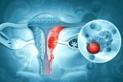 2023 06 12 23 33 1159 Female Reproductive System Diseases Uterus 400