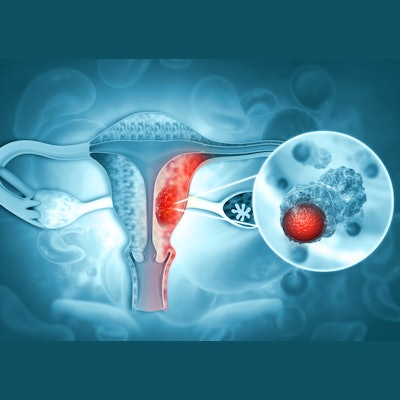 2023 06 12 23 33 1159 Female Reproductive System Diseases Uterus 400
