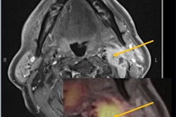 2023 06 13 17 16 6385 2023 06 13 Ismrm 2023 Molecular Imaging Insider Fig1 20230613172218