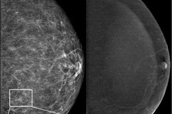 2023 06 22 23 43 3943 2023 06 20 Radiology Cem Ai 20230622231608