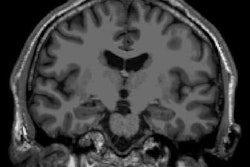 2023 06 27 22 52 1743 2023 06 26 Age Brain Juxtaposition 20230628155037