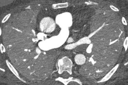 2023 07 11 15 53 7911 2023 07 11 Pcct Lung Figure10 20230711152704