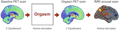 A graphical abstract. Image courtesy of the Journal of Nuclear Medicine through CC BY 4.0.