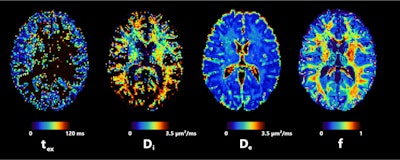 Axial slice of NEXI parametric maps in one subject. The first and third images are consistent throughout the cortex; the first image seems to have more white matter, but this cannot be reliably estimated using available diffusion times. The fourth image displays the expected anatomical pattern in white versus gray matter. The second image shows large variability across voxels while hitting its upper bound frequently. All figures courtesy of Quentin Uhl et al and presented at ISMRM 2023.