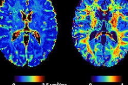 2023 07 18 19 54 5842 2023 07 19 Mri Insider Fig 2 400 20230718193513