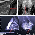 2023 07 25 21 55 3906 2023 07 25 Radiology Wei Figure4 20230725215522