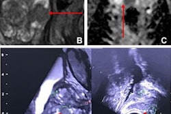 2023 07 25 21 55 3906 2023 07 25 Radiology Wei Figure4 20230725215522