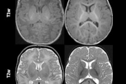 2023 07 31 18 40 1841 2023 07 26 Radiology Ai D Antonoli Image1 400