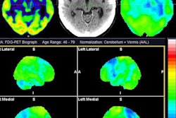 2023 08 21 16 02 8319 2023 08 17 Pet Parkinsonism 20230821162423
