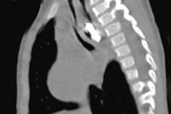 2023 08 23 17 31 8374 2023 08 22 Battery X Ray 20230823174744