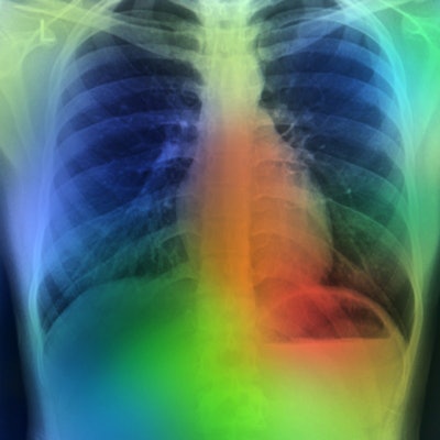 2020 12 04 16 16 3689 Artificial Intelligence Lung Color 400