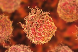 2021 02 19 01 09 5836 Cancer Cells Prostate 400