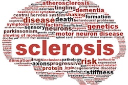 2023 09 05 16 32 2126 Multiple Sclerosis 400