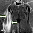 2023 09 06 15 49 9287 2023 09 06 Mri Insider Fig8 Football Brighter 20230906155851