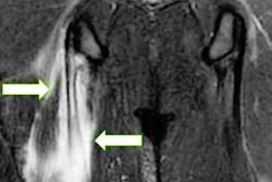 2023 09 06 15 49 9287 2023 09 06 Mri Insider Fig8 Football Brighter 20230906155851