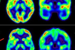 2023 09 08 00 17 9694 2023 09 08 Pet Heart Risk Brain Connection 20230908002439