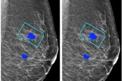 2023 09 08 21 21 5554 2023 09 05 Radiology Ai Mammo 20230908210737