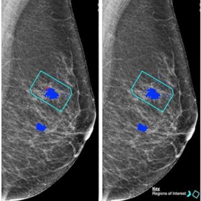 2023 09 08 21 21 5554 2023 09 05 Radiology Ai Mammo 20230908210737