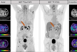 2023 11 20 Fapi Pancreatic