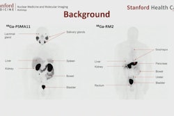 2023 11 27 Prostate Cancer Pet Tracer