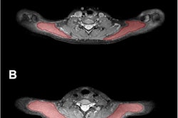 2023 11 29 Quantitative Mri Headache