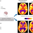 A visual abstract describing a comparison between a portable PET scanner and standard PET scanner. Image courtesy of the Journal of Nuclear Medicine.