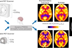 A visual abstract describing a comparison between a portable PET scanner and standard PET scanner. Image courtesy of the Journal of Nuclear Medicine.