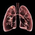 Lung Tuberculosis Art 400