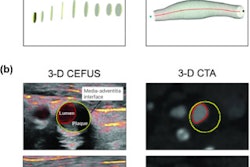 2023 01 03 Umb Cefus Cta