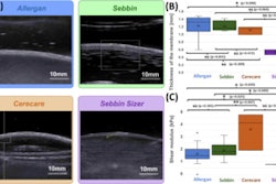 2023 01 20 J Bio M Elastography Implants 65aed0570491b