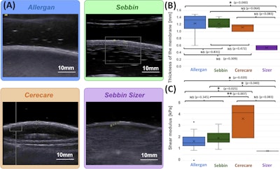 (A) Examples of B-mode images for the measurement of membrane thickness of implants from each of the four types of implants. Images are presented at the same scale. Membrane thicknesses (B) and then shear moduli measured by ARFI method (C) are compared without dissociation as a function of prosthesis age or implantation time. (NS: p-value > 0.05, *: p-value < 0.05, **: p-value < 0.01, ***: p-value < 0.001). Images are available for republishing under a Creative Commons license (CC BY-NC-ND 4.0 Deed) and courtesy of the Journal of Biomechanics.