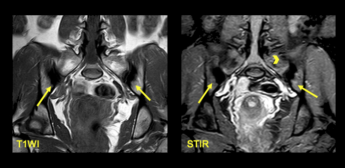 2024 01 25 Mri Insider Slide 15 Thumbnail