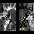 2024 01 25 Mri Insider Slide 15 Thumbnail