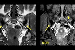 2024 01 25 Mri Insider Slide 15 Thumbnail
