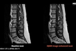 An example of an MRI scan enhanced by Medic Vision's iQMR software. Image courtesy of Medic Vision.