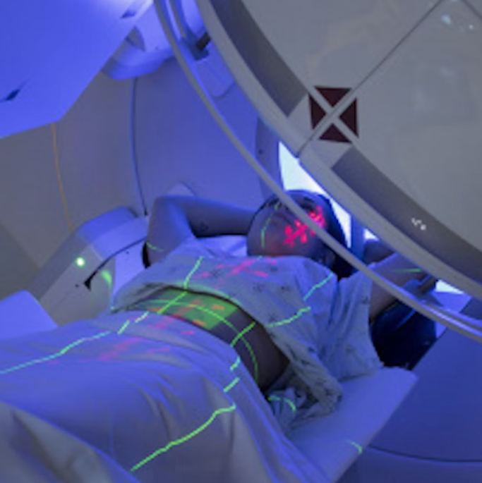 Radiotherapy Uk Image
